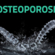 osteoporosi 80x80 - Info Da Poliambulatorio Anver Dicembre 2019